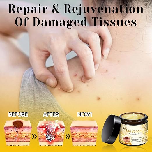 Bee venom cream for all body parts by My Store, showing a jar of natural skincare cream with bee venom ingredients.