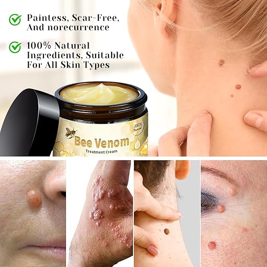 Bee venom cream for all body parts by My Store, showing a jar of natural skincare with bee venom ingredients.